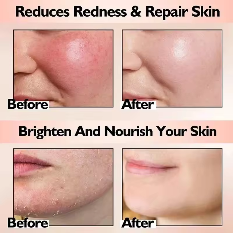 Facial Redness Repair Cream Im - Beauty Makeup Cream 评论和价格