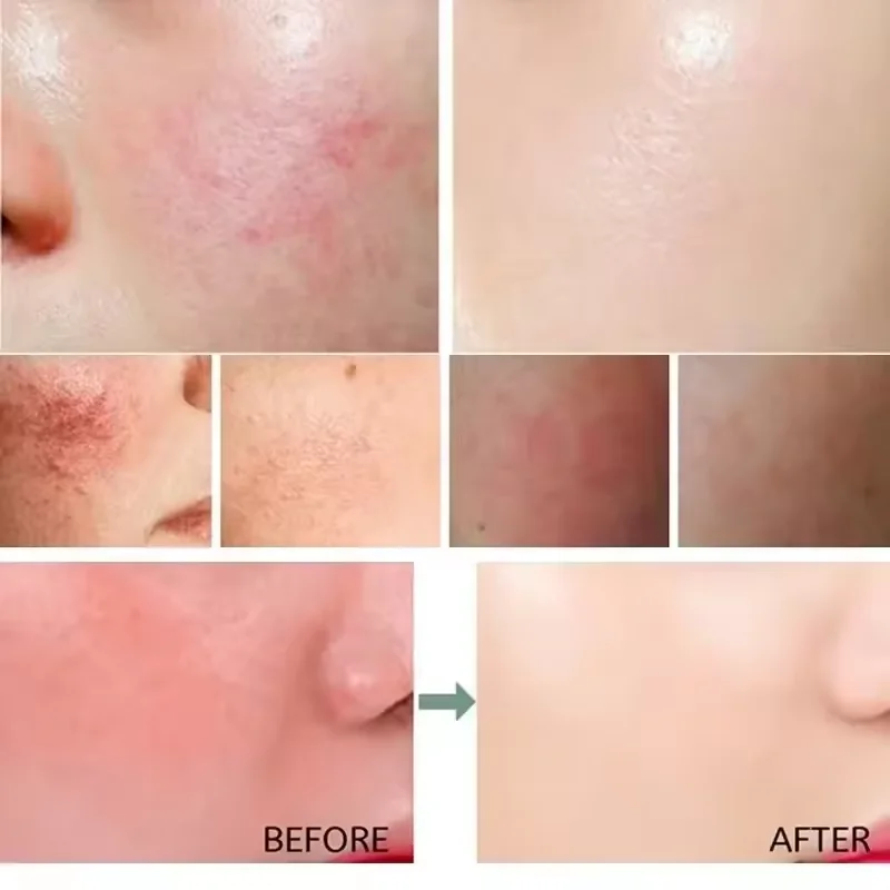Facial Redness Repair Cream Im - Beauty Makeup Cream 评论和价格
